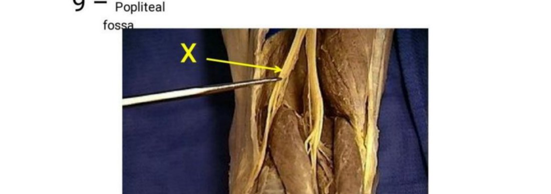 Q9 - popliteal fossa dissection with X tagged
