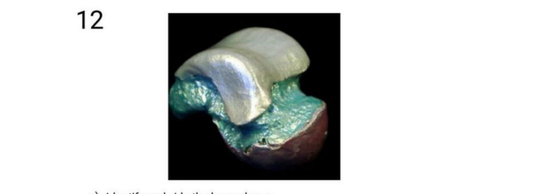 Q12 - isolated tarsal bone specimen
