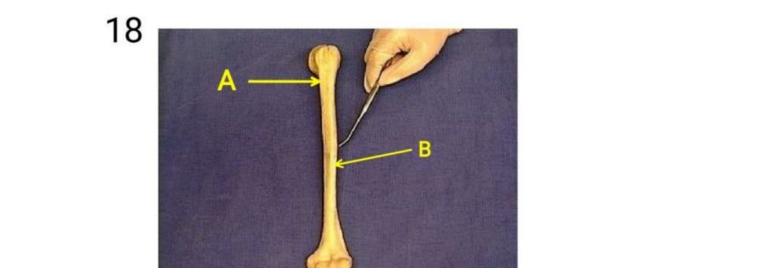 Q18 - shoulder drop (A) and wrist drop (B)