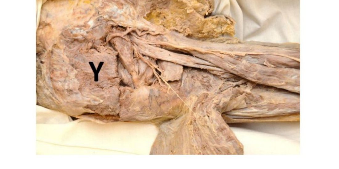 Thigh dissection with muscle Y labelled