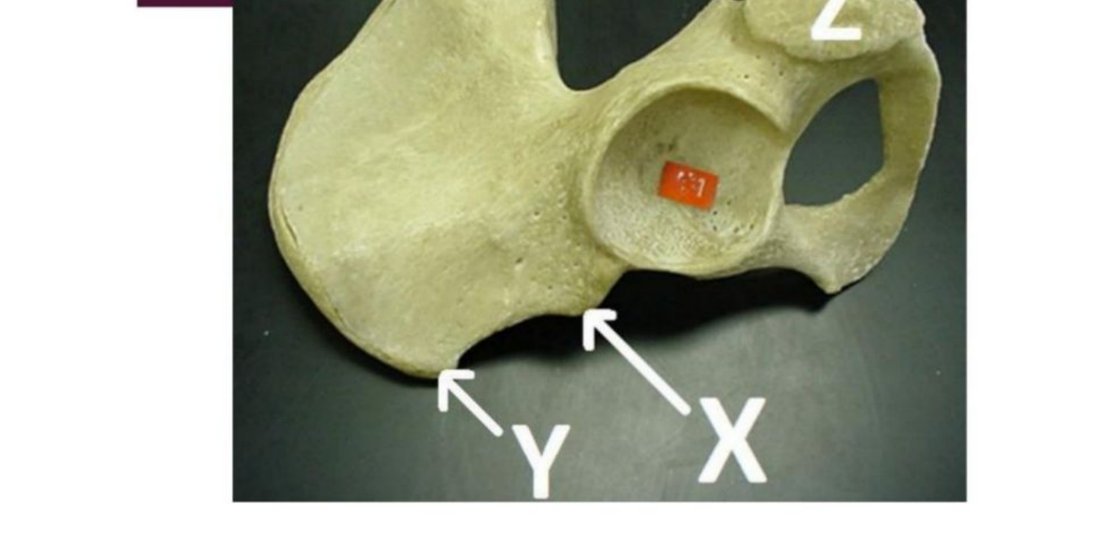 Hip bone specimen with regions X, Y, Z labelled