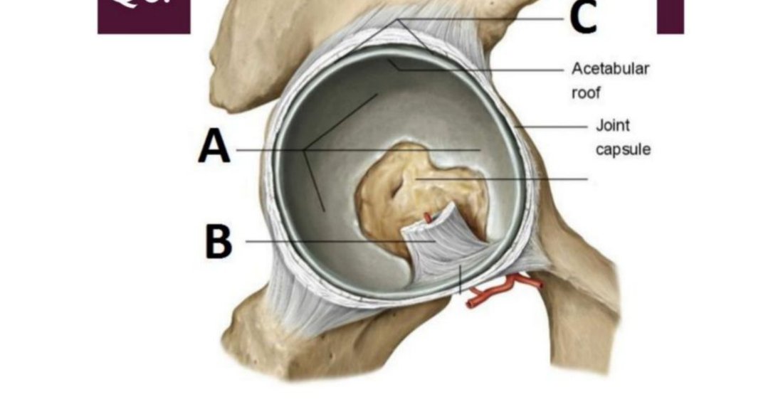 Coronal illustration of the hip joint with A, B, C labelled