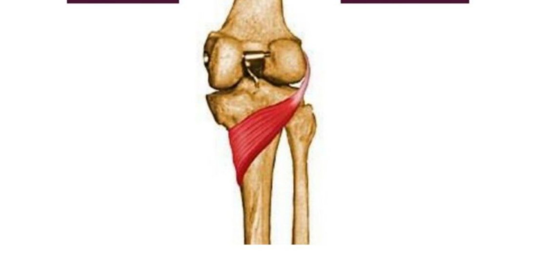 Posterior knee illustration showing popliteus muscle