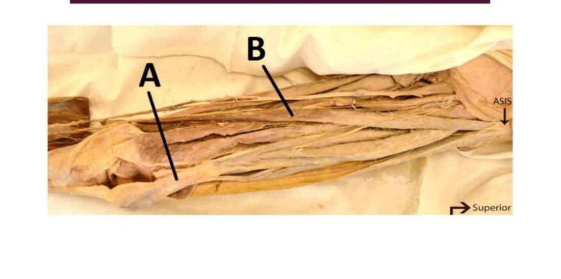 Groin dissection with A and B labelled, ASIS marked