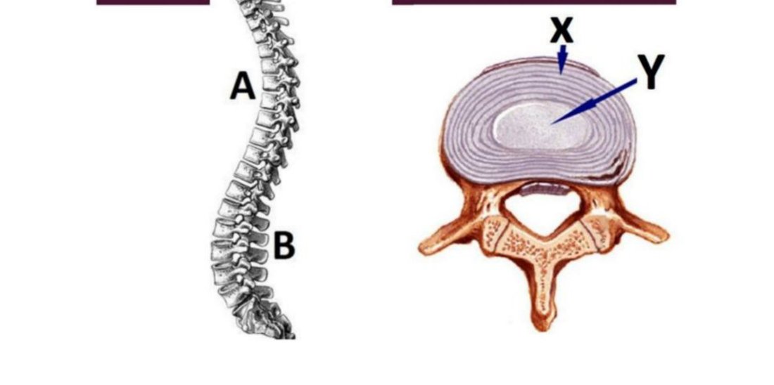 Vertebra with intervertebral disc A labelled