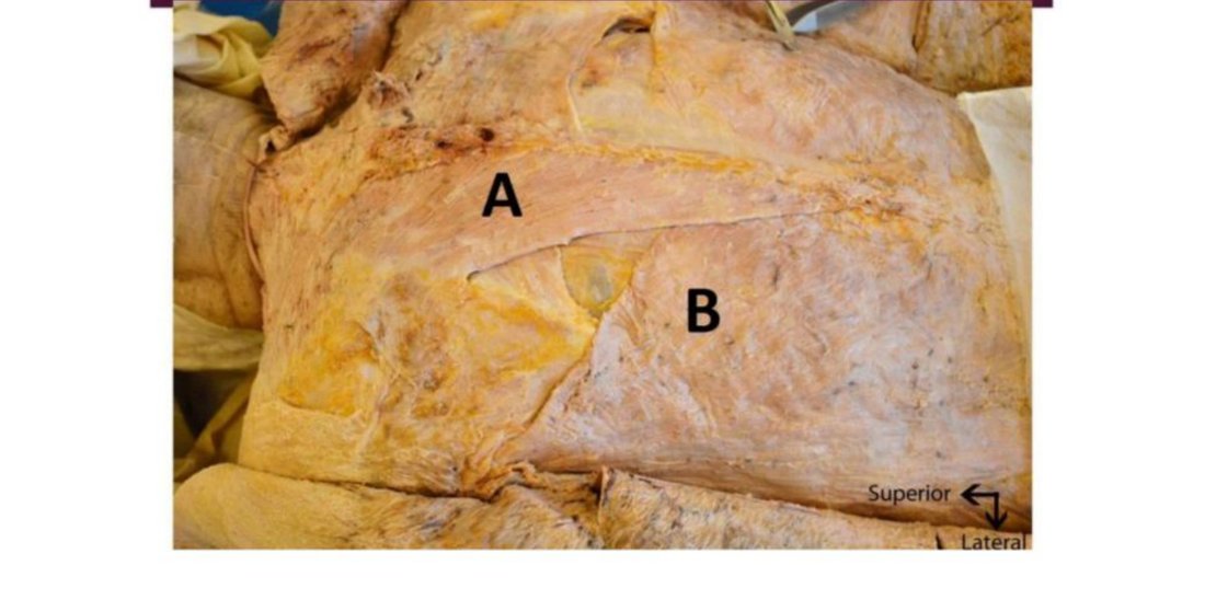 Back dissection with muscles A and B labelled