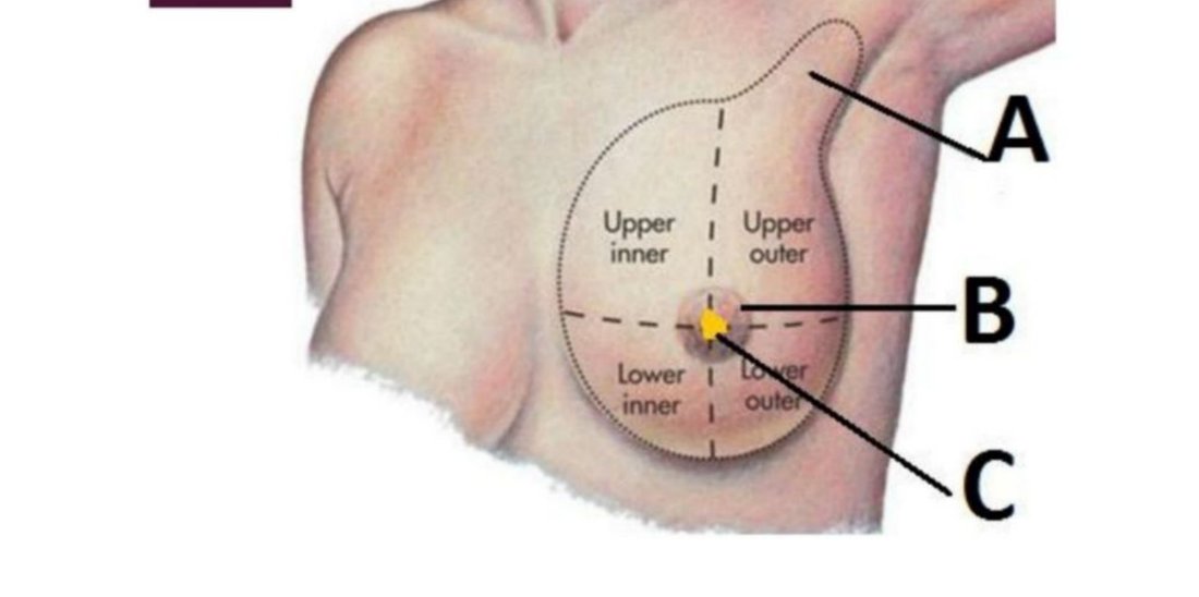 Breast diagram with axillary tail (A) and areolar region (B) labelled