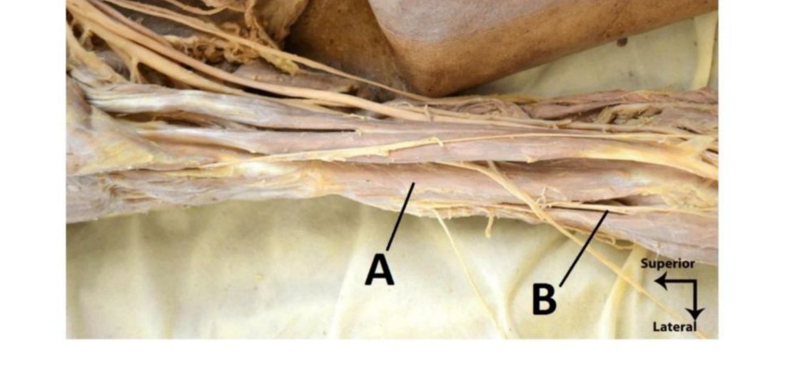 Anterior arm dissection with A and B labelled