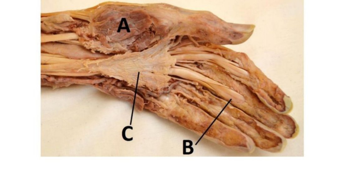 Palm dissection with A, B, C labelled