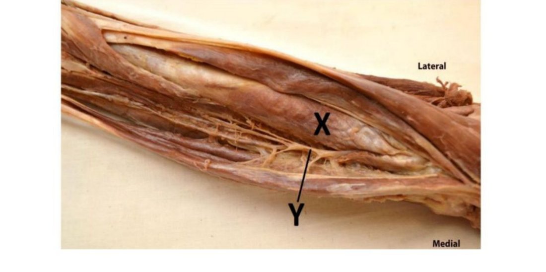 Forearm dissection with muscle X and nerve Y labelled