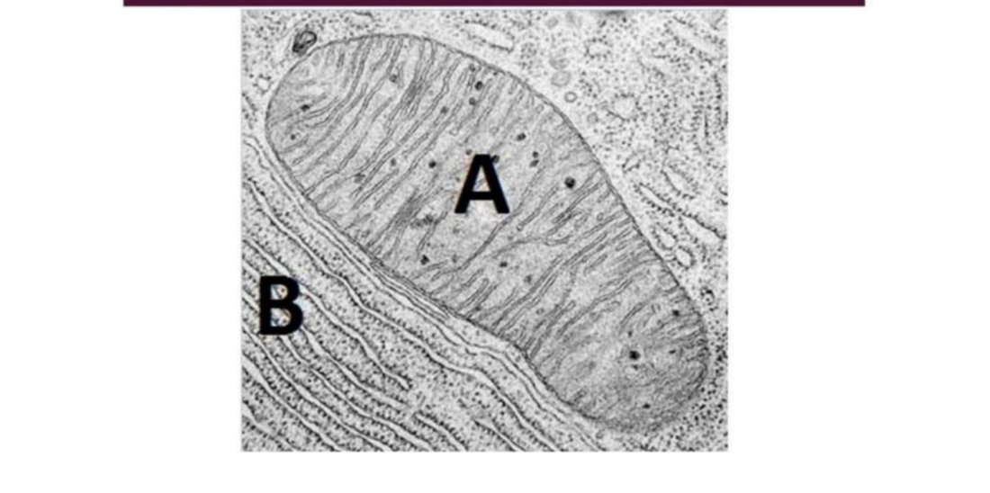 Electron micrograph of a mitochondrion (A) beside rough endoplasmic reticulum (B)