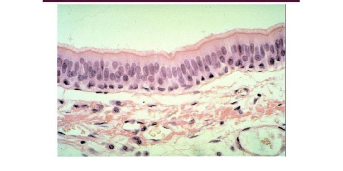 Photomicrograph of pseudostratified ciliated columnar epithelium