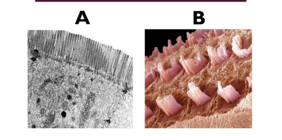 Electron micrograph of microvilli (A) beside a coloured SEM image of stereocilia (B)