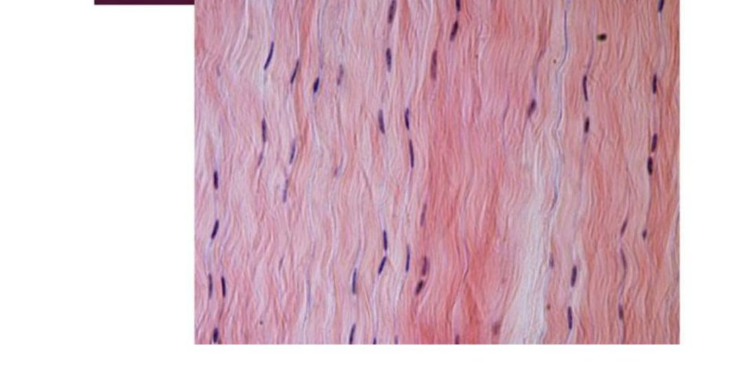 Photomicrograph of dense regular connective tissue with parallel collagen fibres