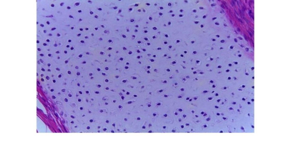 Photomicrograph of hyaline cartilage with chondrocytes in lacunae