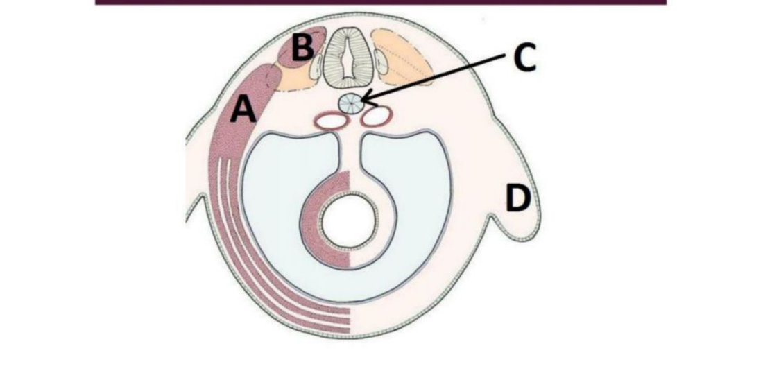 Cross-section through pharyngeal arches with arch muscle mass (A) and arch cartilage (B) labelled