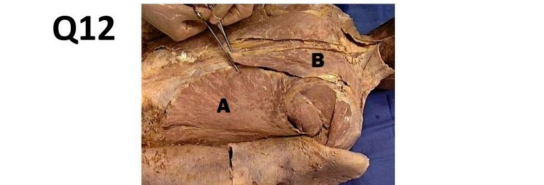 Q12 - back dissection with A and B labelled