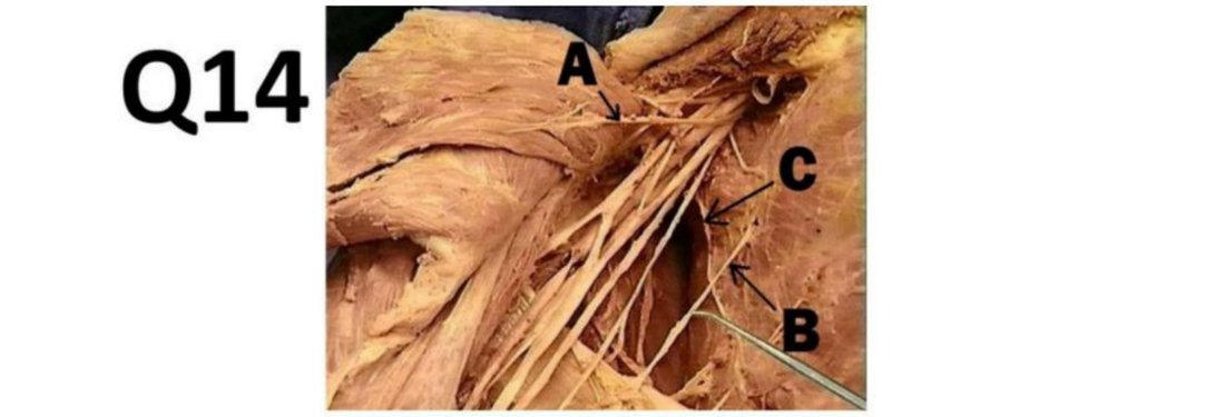 Q14 - axilla dissection with A, B, C labelled