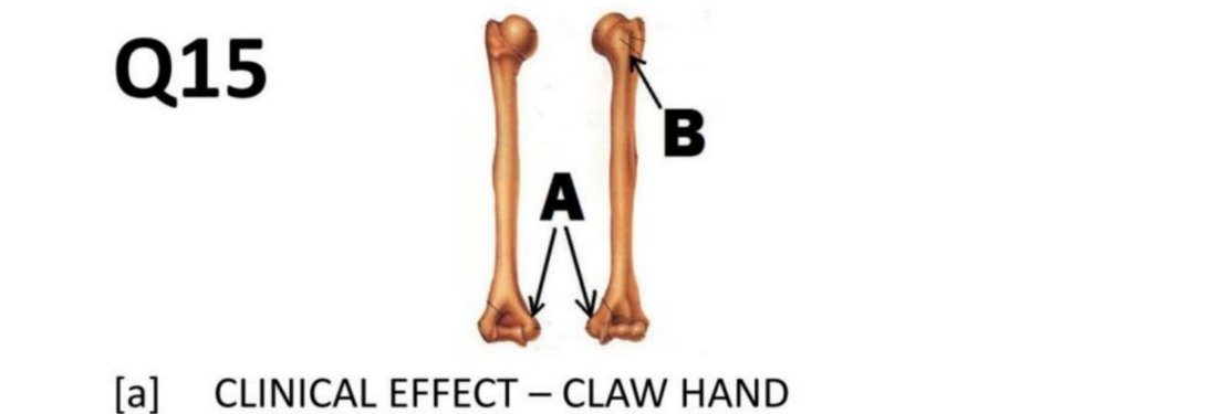 Q15 - humerus specimen with A and B labelled