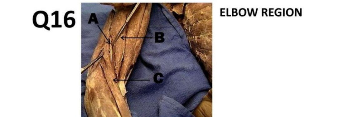 Q16 - elbow region dissection with A, B, C labelled