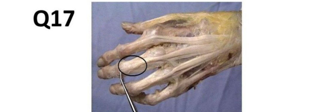 Q17 - hand dissection with the fingertip circled