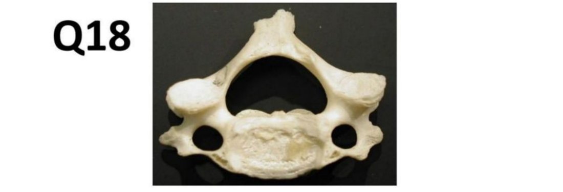 Q18 - isolated vertebra specimen