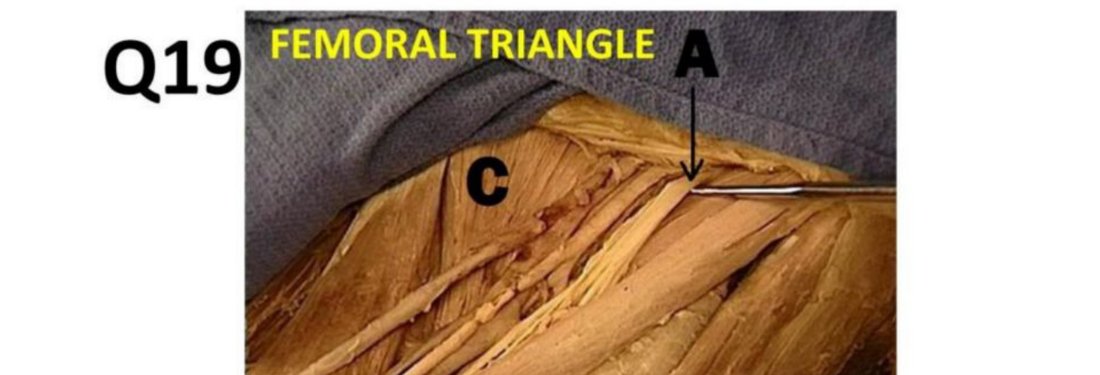 Q19 - femoral triangle dissection labelled "FEMORAL TRIANGLE"