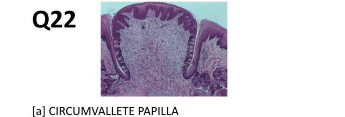 Q22 - tongue papilla histology