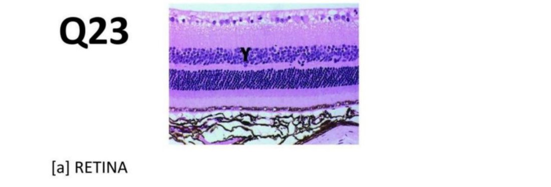 Q23 - retina histology with a layer labelled Y