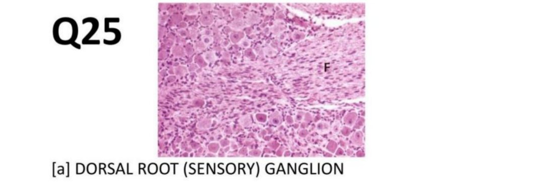 Q25 - dorsal root ganglion histology with F labelled