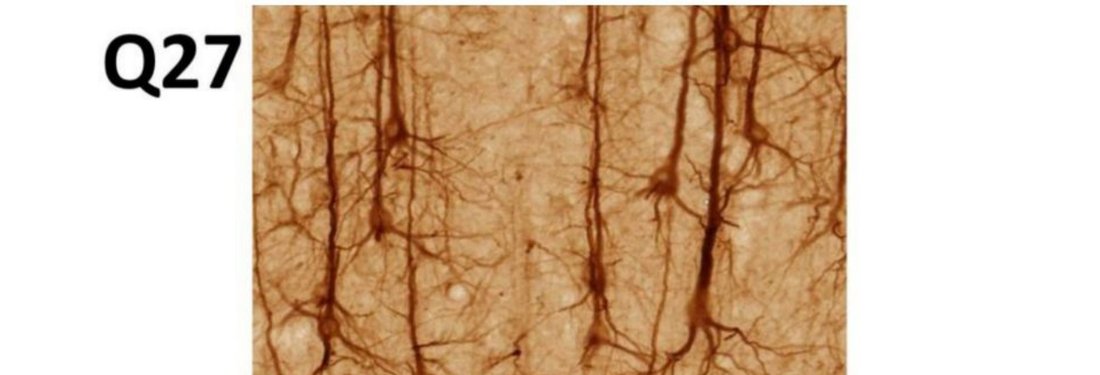 Q27 - cerebral cortex neuron histology