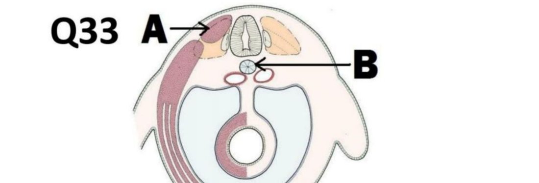 Q33 - vertebral cross-section diagram with A and B labelled
