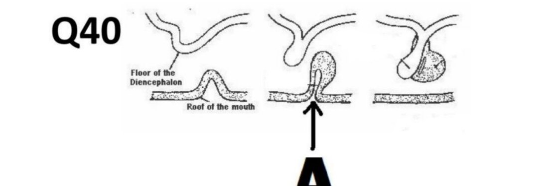 Q40 - diagram of Rathke's pouch formation