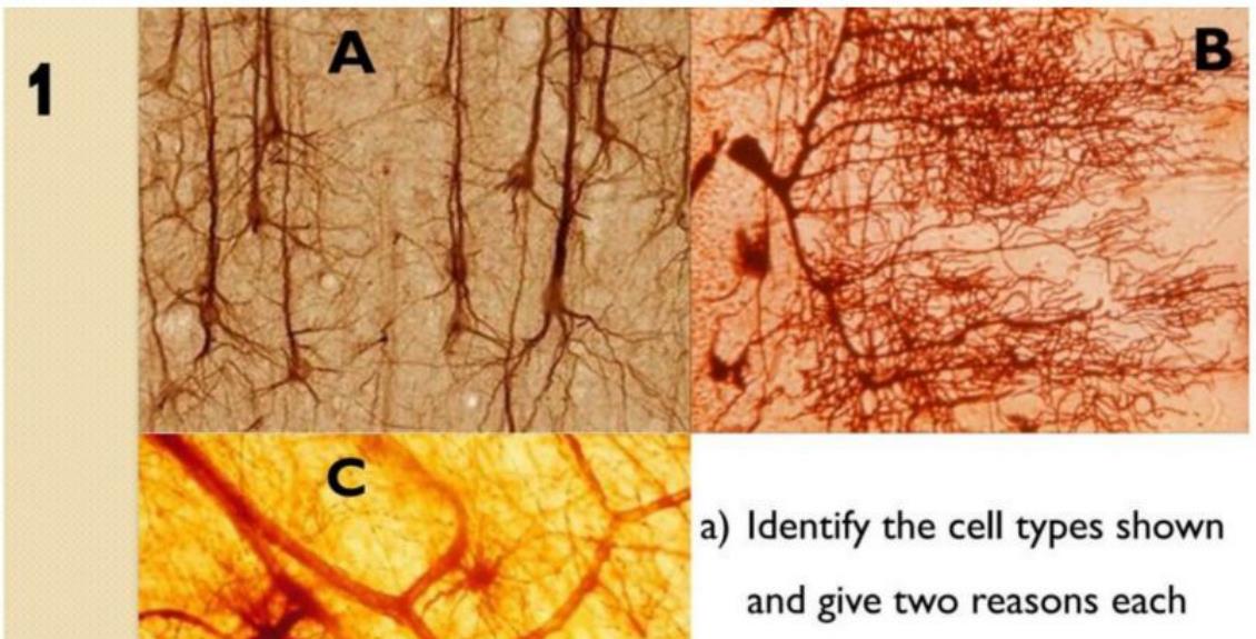 Pyramidal cell, Purkinje cell, and astrocytes