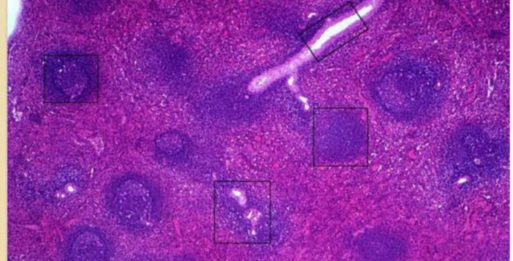 Spleen