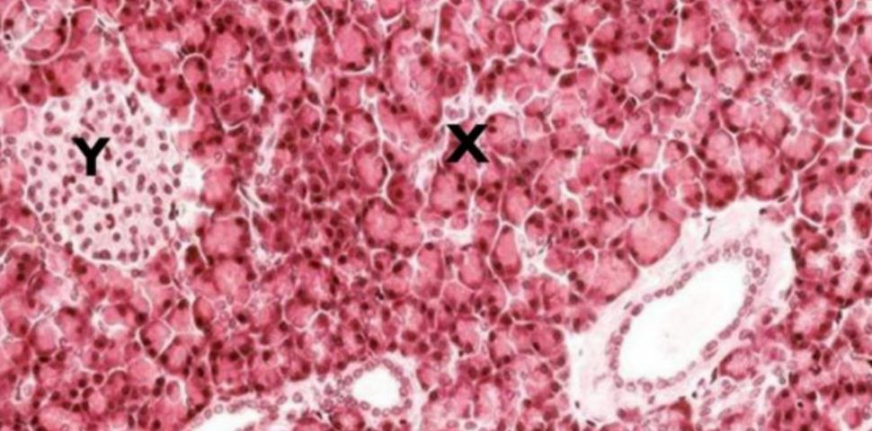 Pancreas with exocrine acini and an islet
