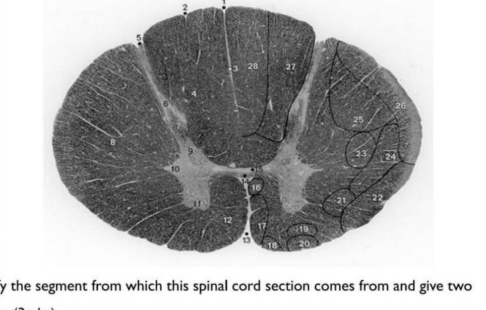 Thoracic spinal cord cross-section with numbered regions