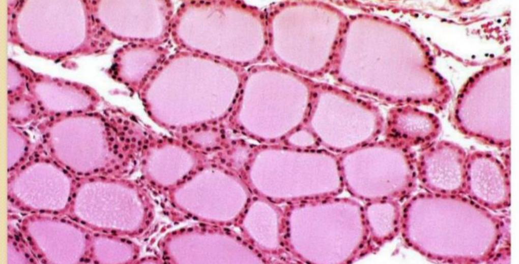 Thyroid gland