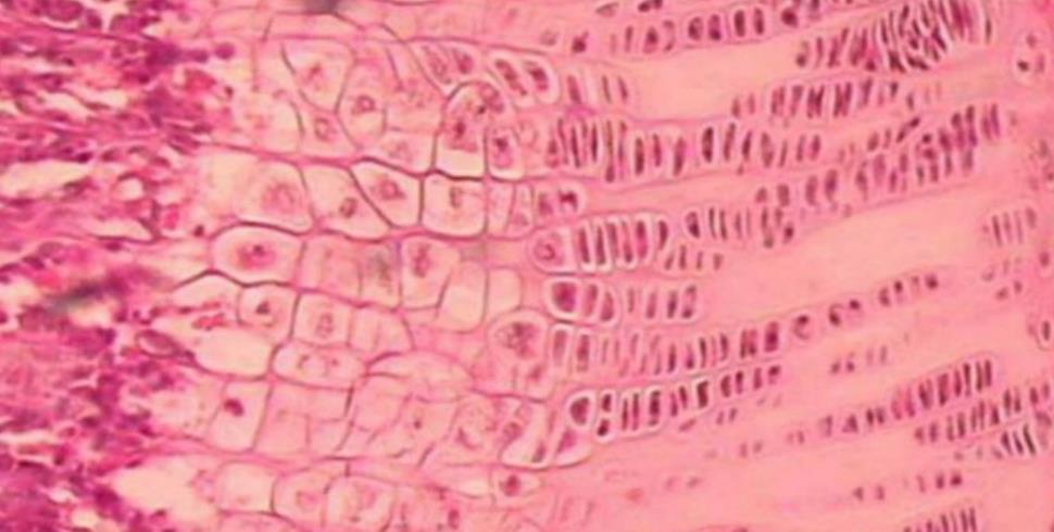 Epiphyseal growth plate