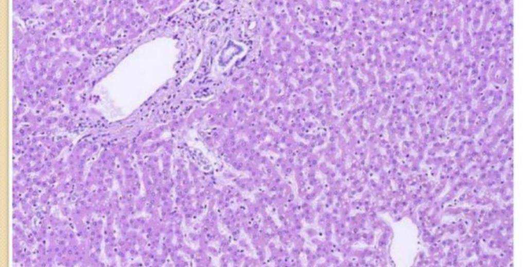 Liver histology