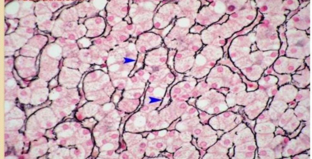 Reticular fibres