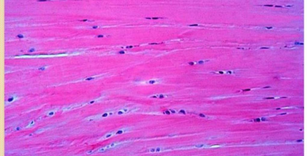 Fibrocartilage