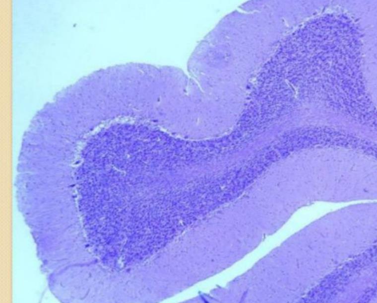 Cerebellar folium