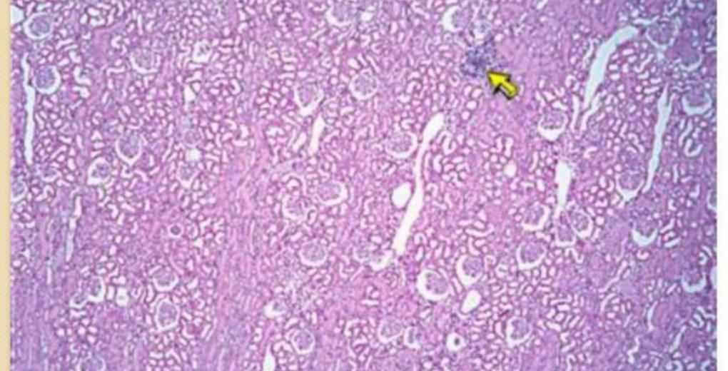 Kidney histology