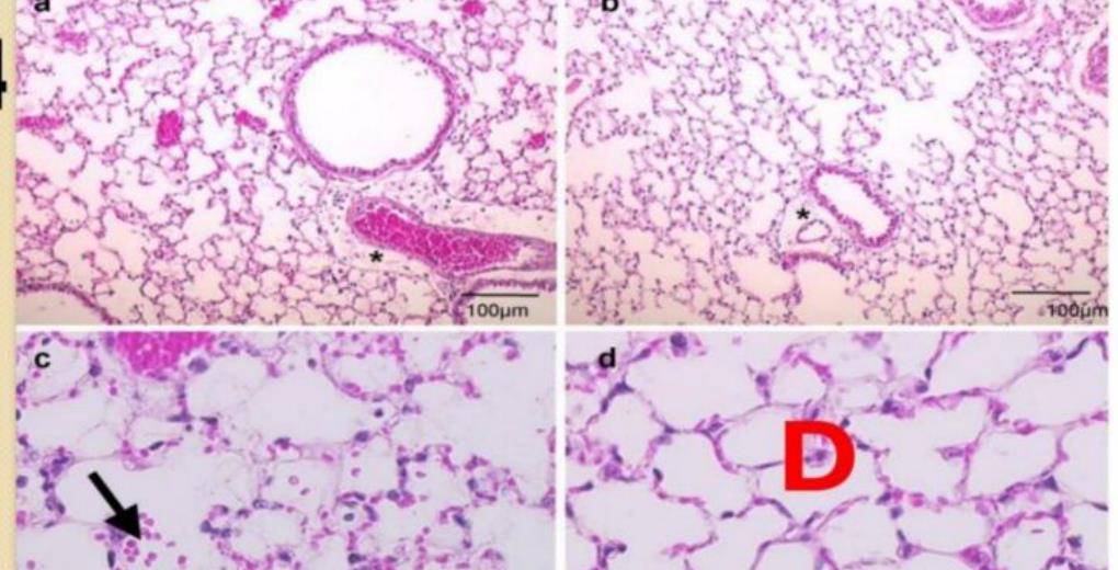 Lung histology with zone D