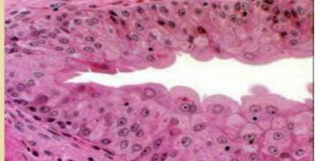 Transitional epithelium