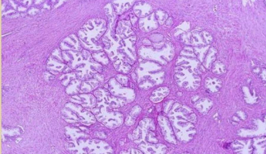 Prostate gland