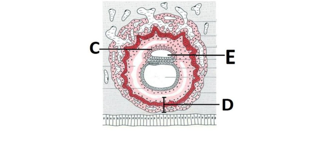 Cross-section through chorionic villus with labels C, D, E