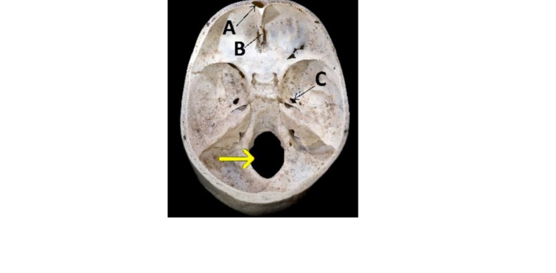 Base of skull, anterior cranial fossa with A, B, C labelled