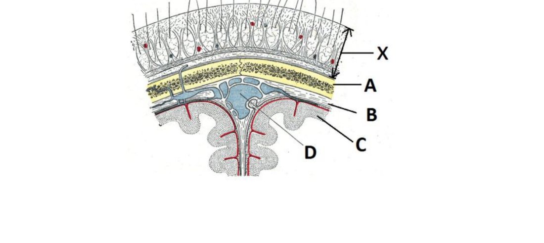 Coronal section through the scalp and meninges with X, A, B, C, D labelled